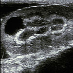 Abdominale Sonografie